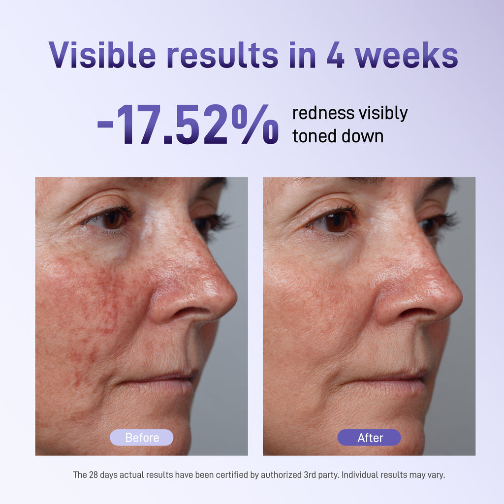 Bixdo Whitening LED Mask