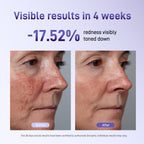 Bixdo Whitening LED Mask