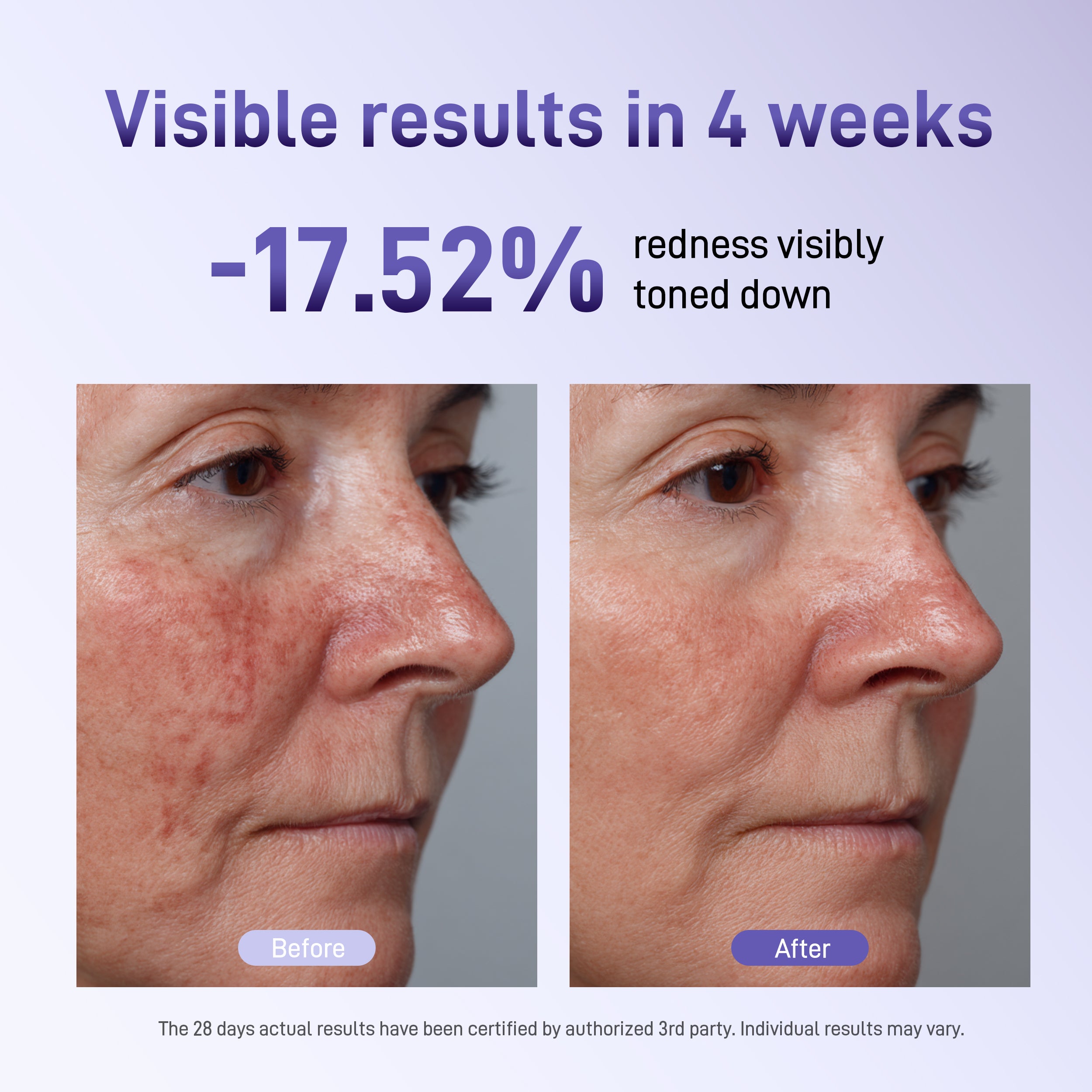 Bixdo Whitening LED Mask