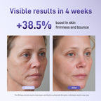 Bixdo Whitening LED Mask